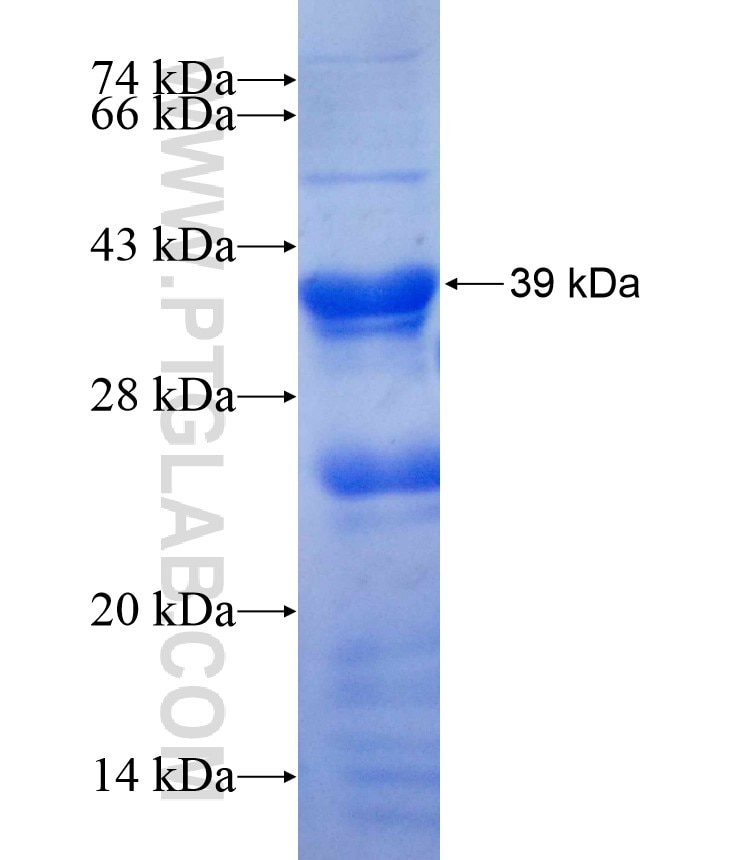 SMO fusion protein Ag16993 SDS-PAGE