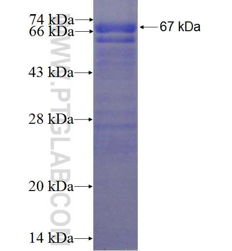SMOC1 fusion protein Ag1616 SDS-PAGE