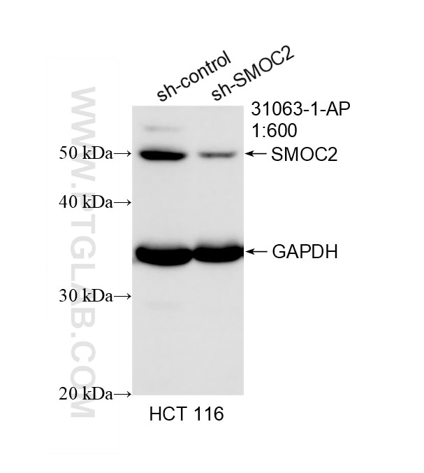 WB result of SMOC2 antibody (31063-1-AP; 1:600; incubated at room temperature for 1.5 hours) with sh-Control and sh-SMOC2 transfected HCT 116 cells. Western Blot (WB) analysis of HCT 116 cells using SMOC2 Polyclonal antibody (31063-1-AP)