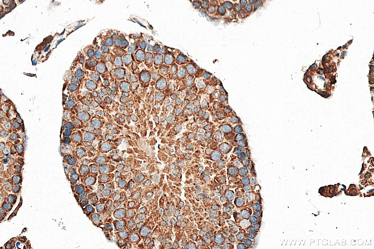 IHC staining of mouse testis using 15052-1-AP Immunohistochemistry (IHC) staining of mouse testis tissue using SMOX Polyclonal antibody (15052-1-AP)