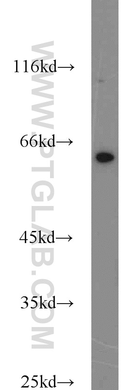 Western Blot (WB) analysis of PC-13 cells using SMOX Polyclonal antibody (15052-1-AP)