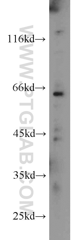 Western Blot (WB) analysis of MCF-7 cells using SMOX Polyclonal antibody (15052-1-AP)