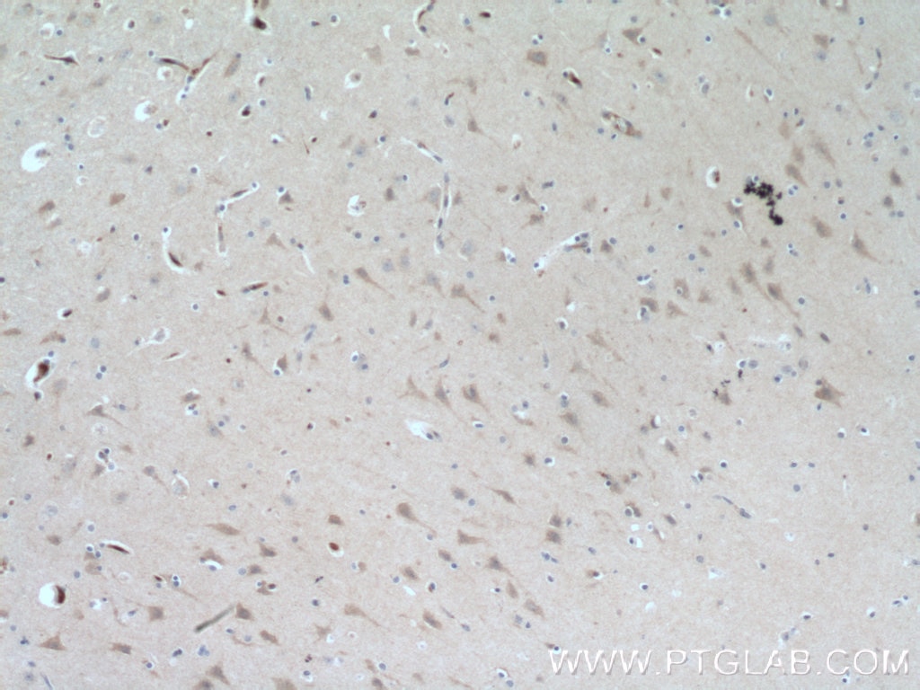 Immunohistochemistry (IHC) staining of human brain tissue using SMPD1,ASM Polyclonal antibody (14609-1-AP)