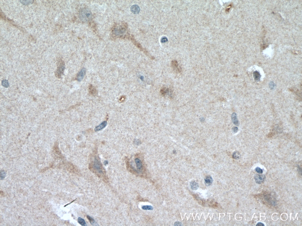 Immunohistochemistry (IHC) staining of human brain tissue using SMPD1,ASM Polyclonal antibody (14609-1-AP)