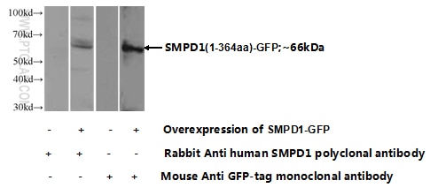 SMPD1,ASM