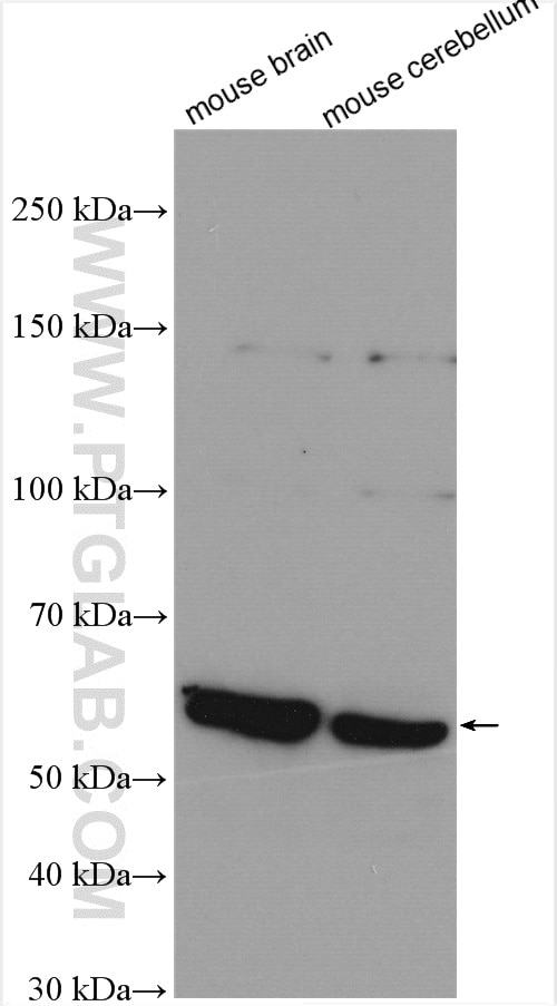 Western Blot (WB) analysis of various lysates using SMPD1,ASM Polyclonal antibody (14609-1-AP)