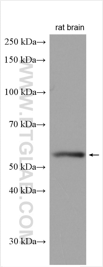 Western Blot (WB) analysis of rat brain tissue using SMPD1,ASM Polyclonal antibody (14609-1-AP)