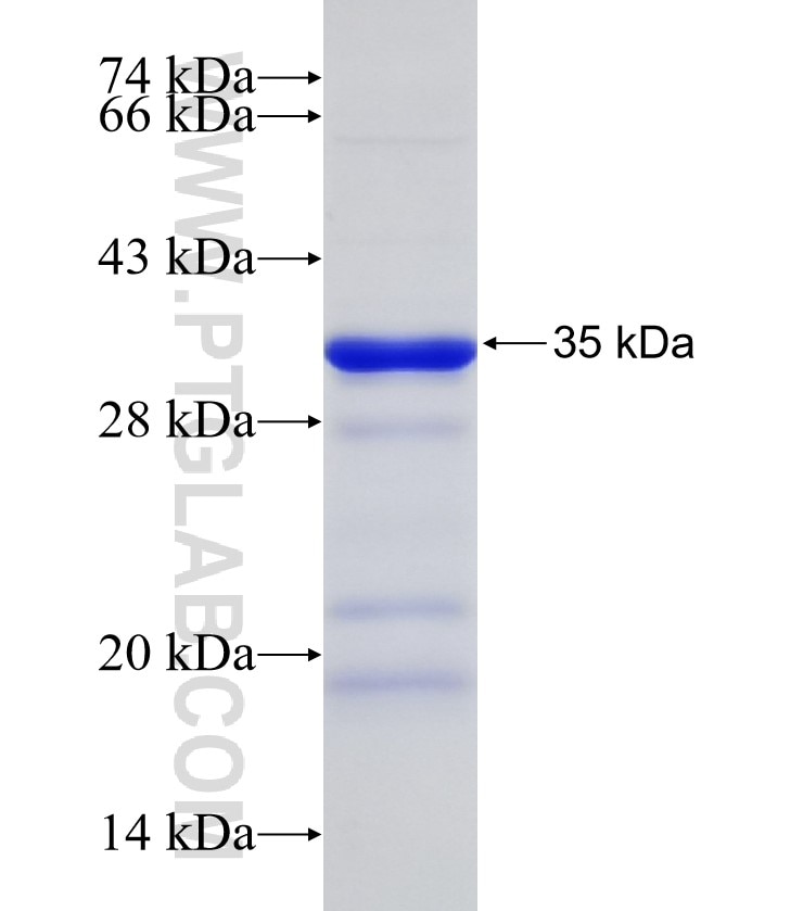 SMPD1,ASM fusion protein Ag6180 SDS-PAGE