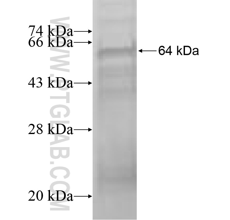 SMPDL3A fusion protein Ag9340 SDS-PAGE