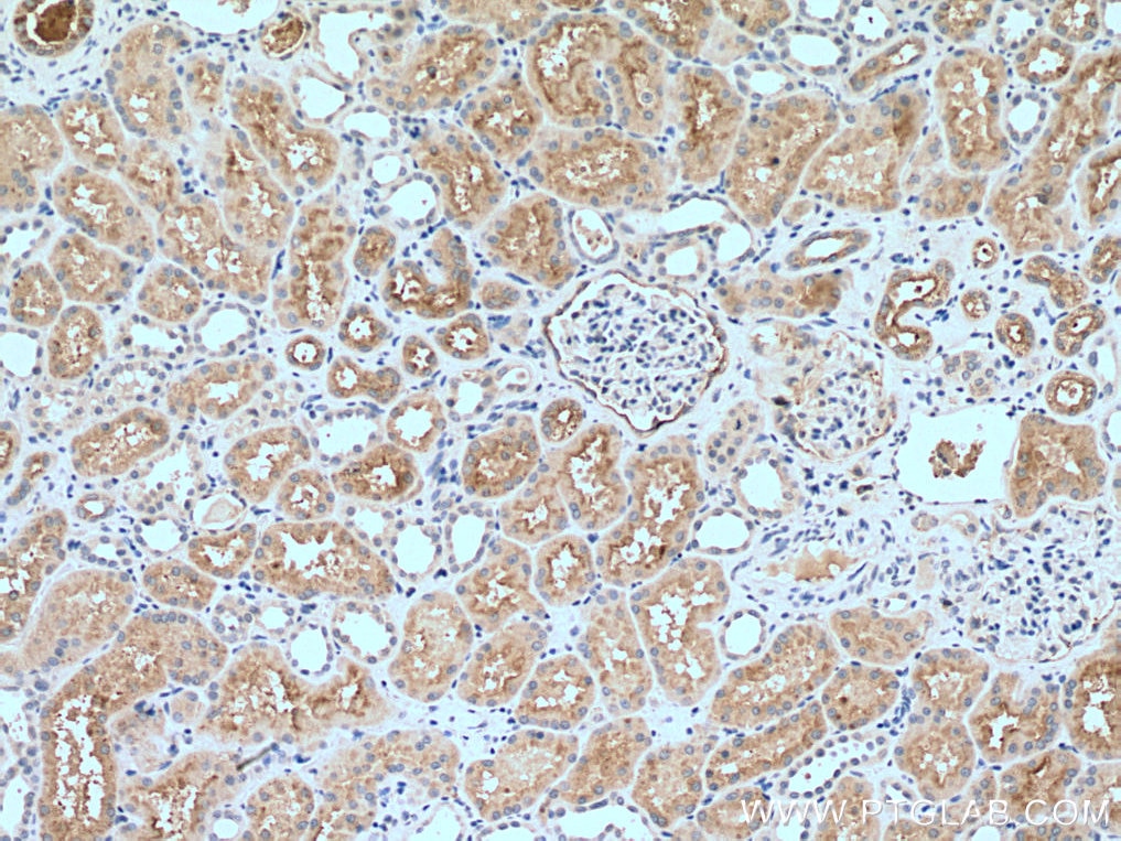 IHC staining of human kidney using 16552-1-AP