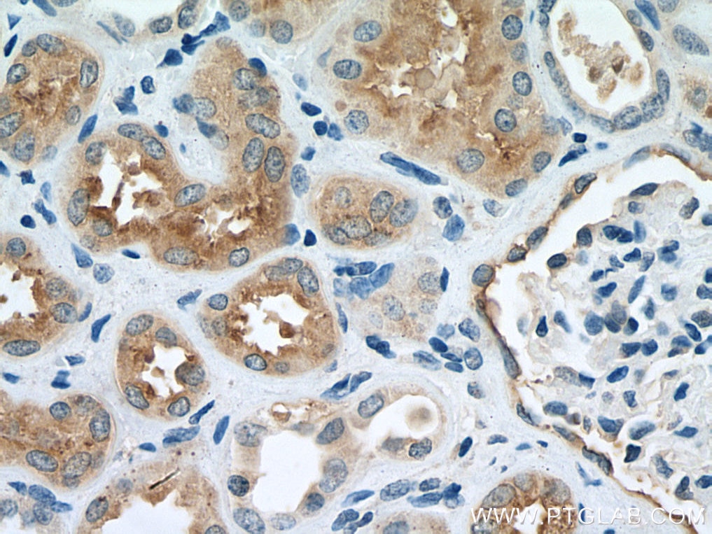 Immunohistochemistry (IHC) staining of human kidney tissue using SMPDL3B Polyclonal antibody (16552-1-AP)