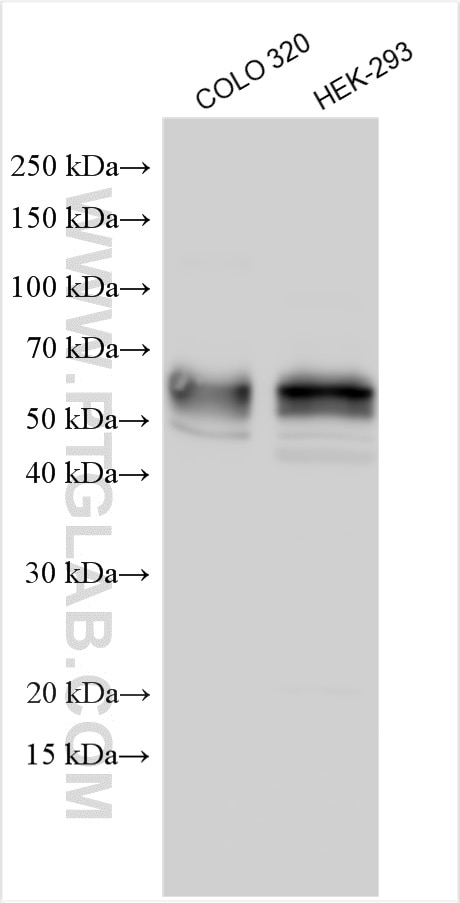 Western Blot (WB) analysis of various lysates using SMPDL3B Polyclonal antibody (16552-1-AP)