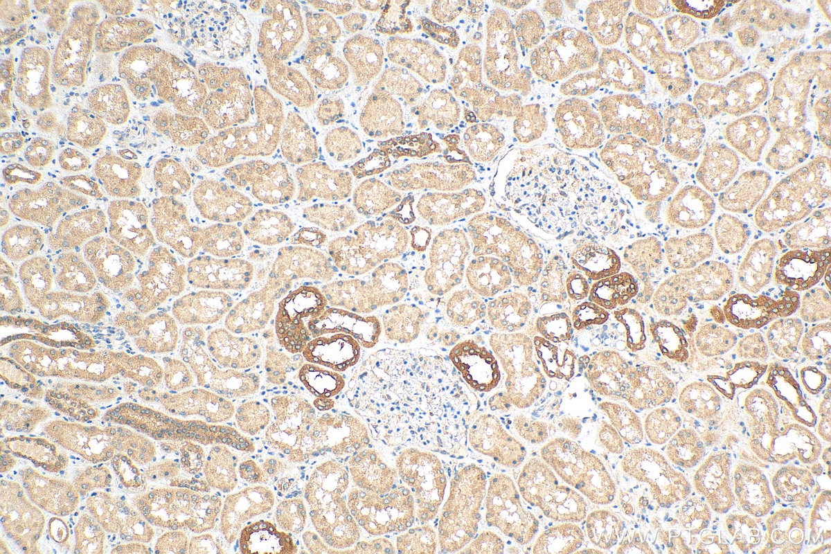 Immunohistochemistry (IHC) staining of human kidney tissue using SMPX Polyclonal antibody (15791-1-AP)