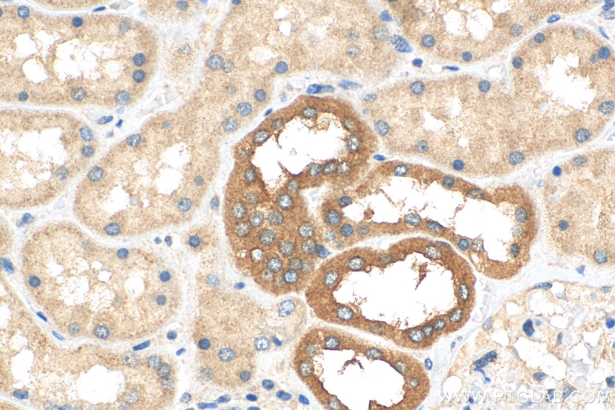 Immunohistochemistry (IHC) staining of human kidney tissue using SMPX Polyclonal antibody (15791-1-AP)