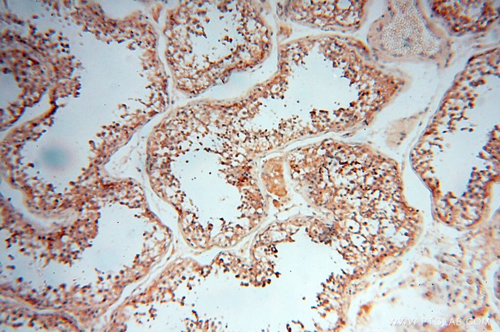 Immunohistochemistry (IHC) staining of human testis tissue using SMPX Polyclonal antibody (15791-1-AP)