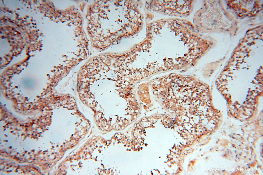 IHC staining of human testis using 15791-1-AP