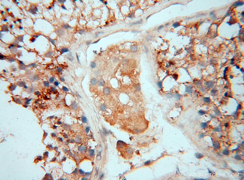 Immunohistochemistry (IHC) staining of human testis tissue using SMPX Polyclonal antibody (15791-1-AP)