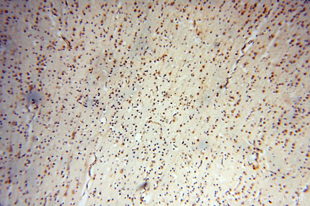 Immunohistochemistry (IHC) staining of human brain tissue using SMPX Polyclonal antibody (15791-1-AP)