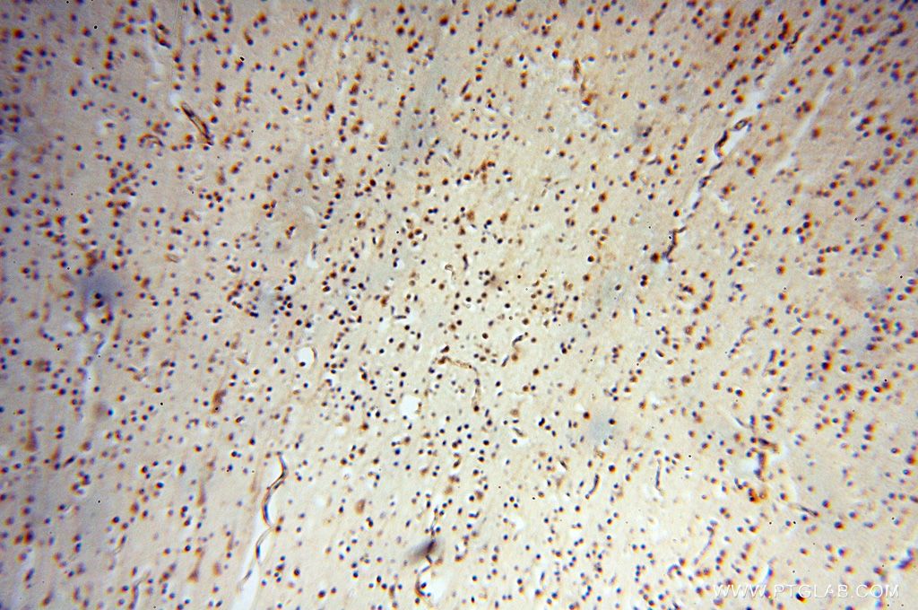 IHC staining of human brain using 15791-1-AP