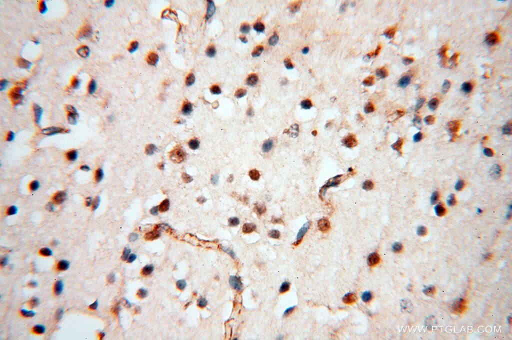 Immunohistochemistry (IHC) staining of human brain tissue using SMPX Polyclonal antibody (15791-1-AP)