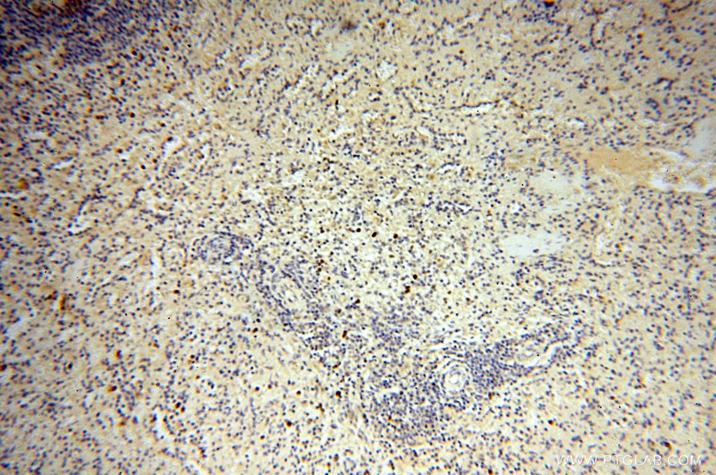 Immunohistochemistry (IHC) staining of human spleen tissue using SMPX Polyclonal antibody (15791-1-AP)