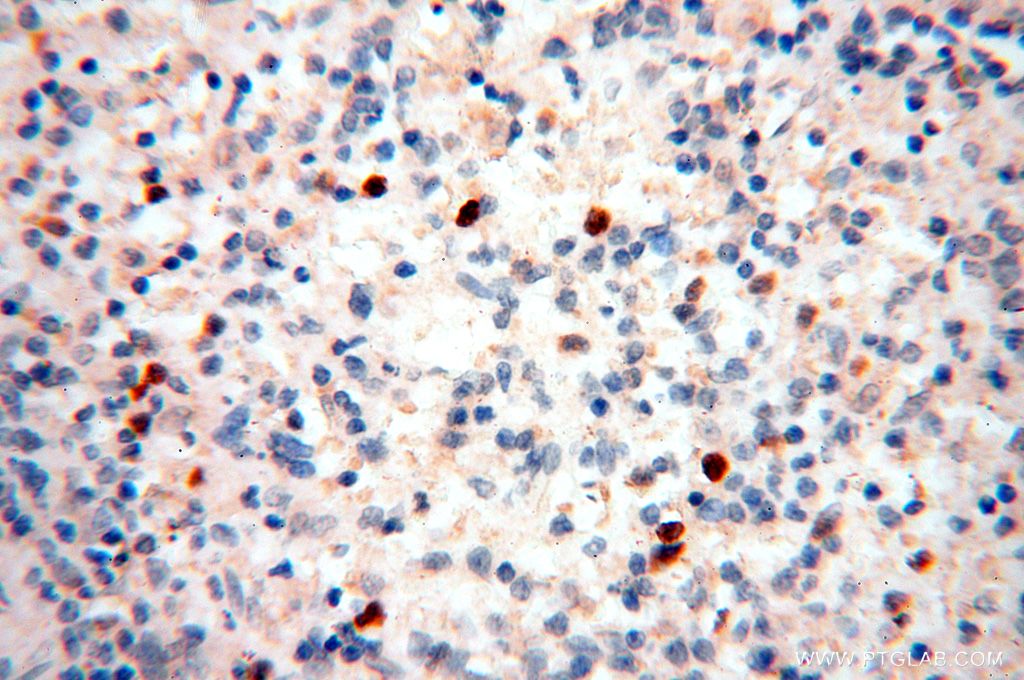 Immunohistochemistry (IHC) staining of human spleen tissue using SMPX Polyclonal antibody (15791-1-AP)