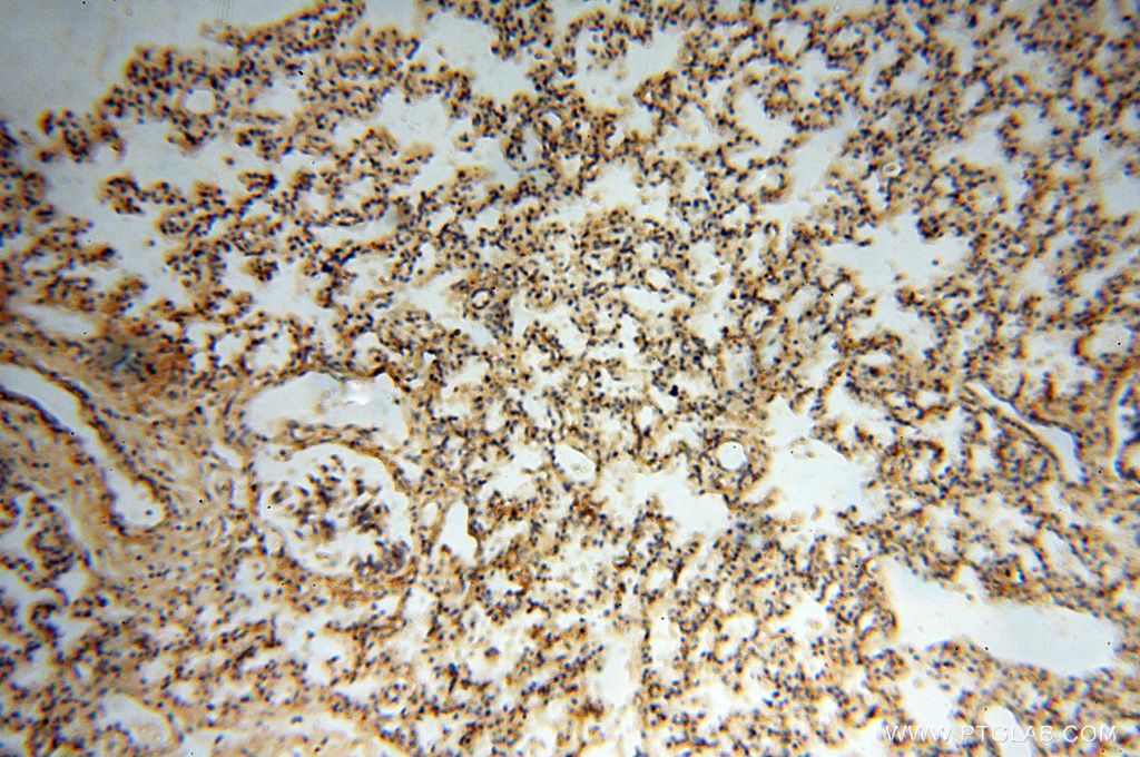 Immunohistochemistry (IHC) staining of human lung tissue using SMPX Polyclonal antibody (15791-1-AP)