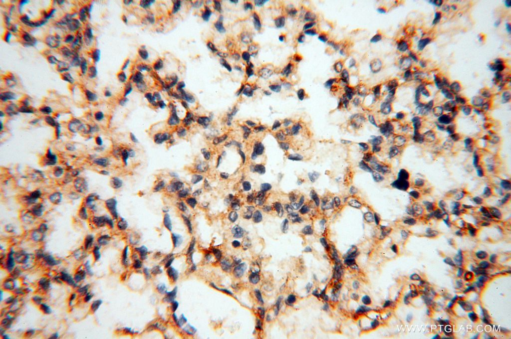 Immunohistochemistry (IHC) staining of human lung tissue using SMPX Polyclonal antibody (15791-1-AP)