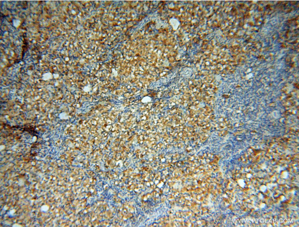 Immunohistochemistry (IHC) staining of human ovary tissue using SMPX Polyclonal antibody (15791-1-AP)