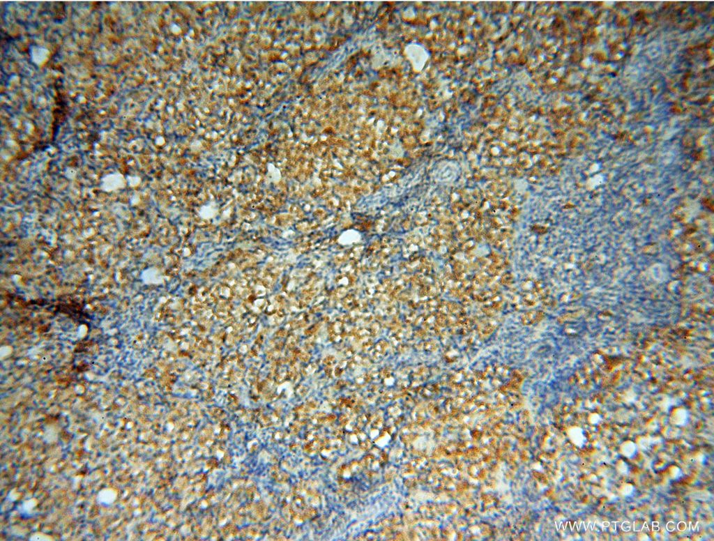 IHC staining of human ovary using 15791-1-AP