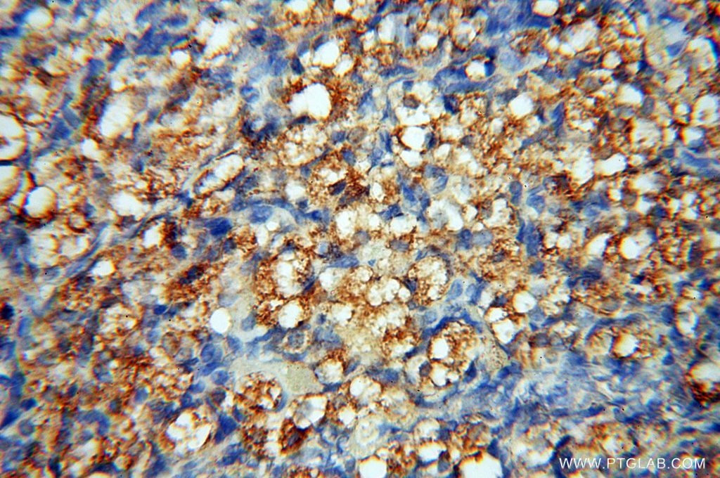 IHC staining of human ovary using 15791-1-AP