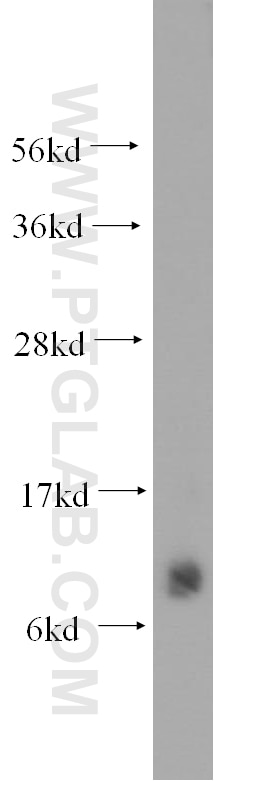 Western Blot (WB) analysis of human skeletal muscle tissue using SMPX Polyclonal antibody (15791-1-AP)