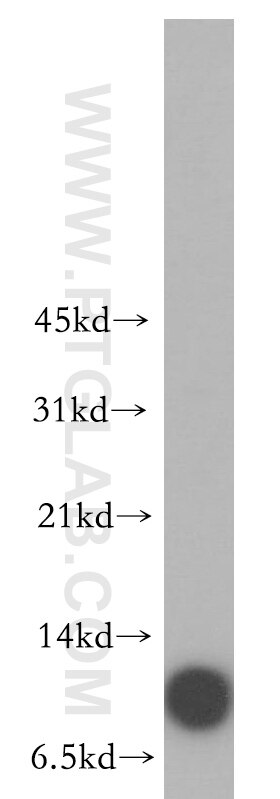 Western Blot (WB) analysis of human colon tissue using SMPX Polyclonal antibody (15791-1-AP)