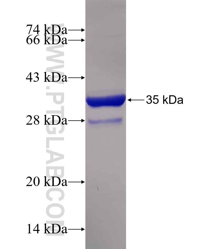 SMPX fusion protein Ag8497 SDS-PAGE