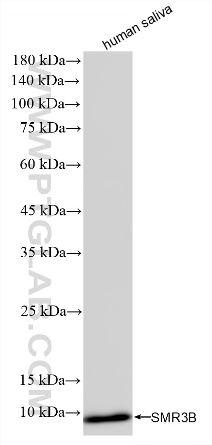 Western Blot (WB) analysis of human saliva using SMR3B Recombinant monoclonal antibody (85745-3-RR)