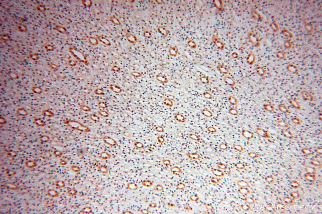 Spermine synthase