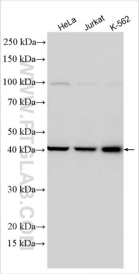 Western Blot (WB) analysis of various lysates using Spermine synthase Polyclonal antibody (15979-1-AP)