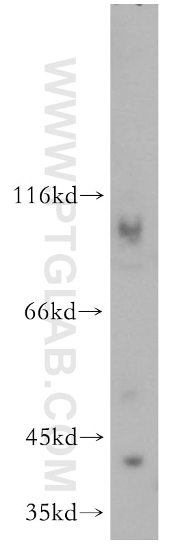 Western Blot (WB) analysis of human heart tissue using Spermine synthase Polyclonal antibody (15979-1-AP)