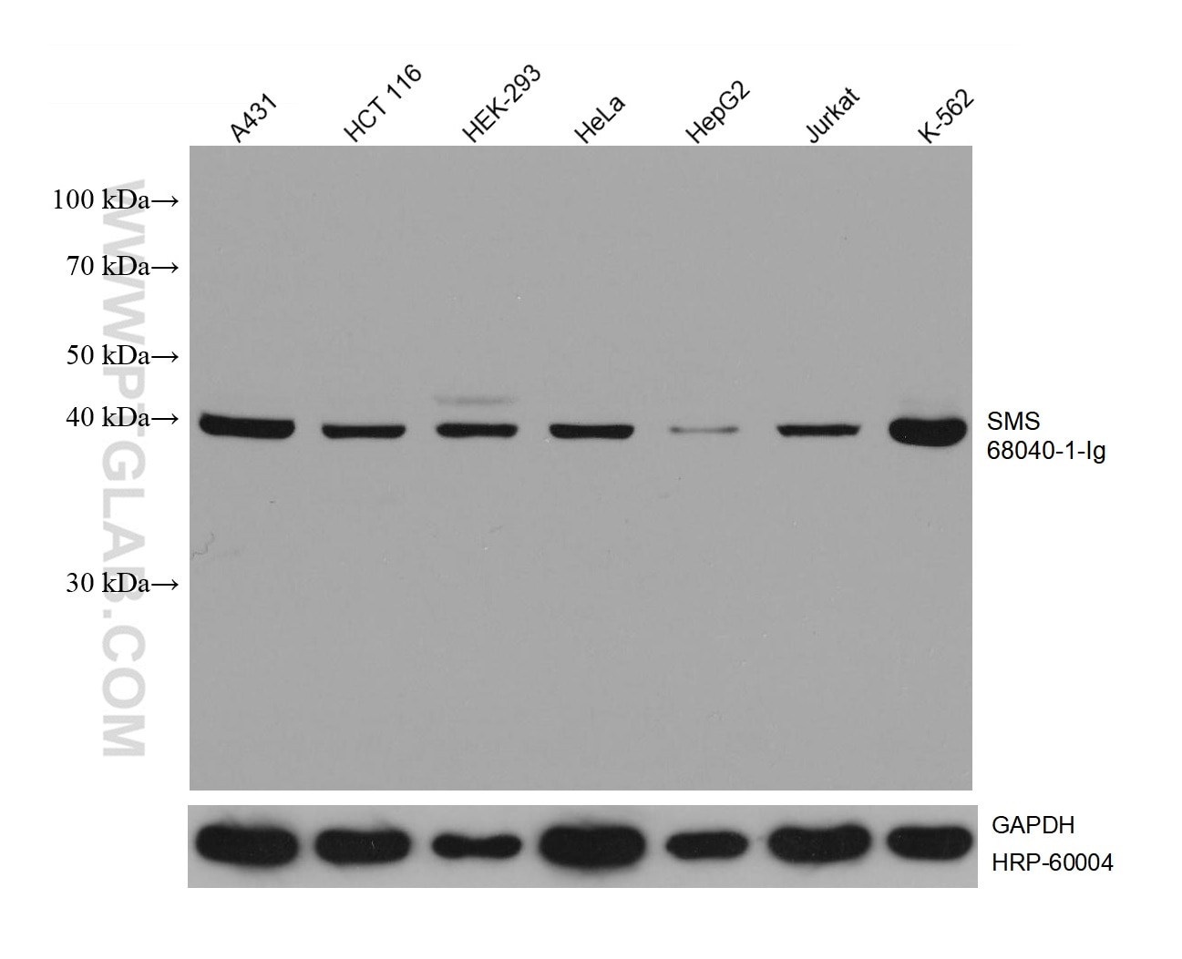 Western Blot (WB) analysis of various lysates using SMS Monoclonal antibody (68040-1-Ig)