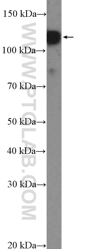 Western Blot (WB) analysis of COLO 320 cells using SMTN Polyclonal antibody (23567-1-AP)