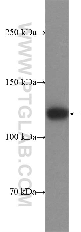 Western Blot (WB) analysis of COLO 320 cells using SMTN Polyclonal antibody (23567-1-AP)