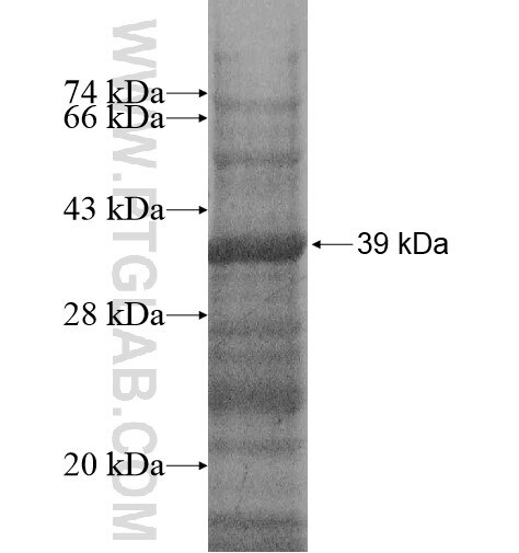 SMTN fusion protein Ag14610 SDS-PAGE