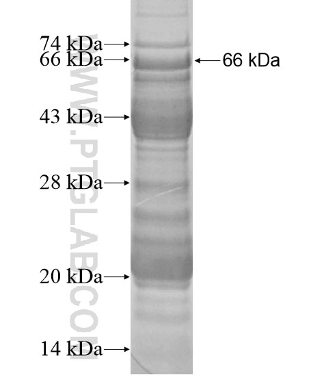 SMTN fusion protein Ag19983 SDS-PAGE