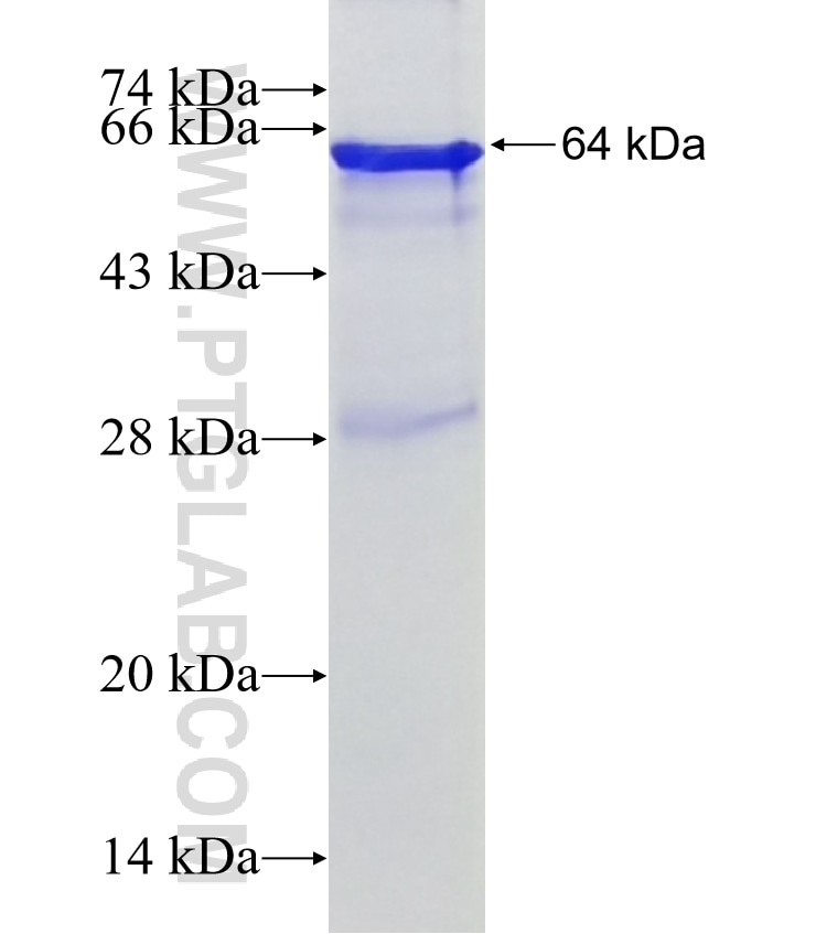 SMTN fusion protein Ag19983 SDS-PAGE