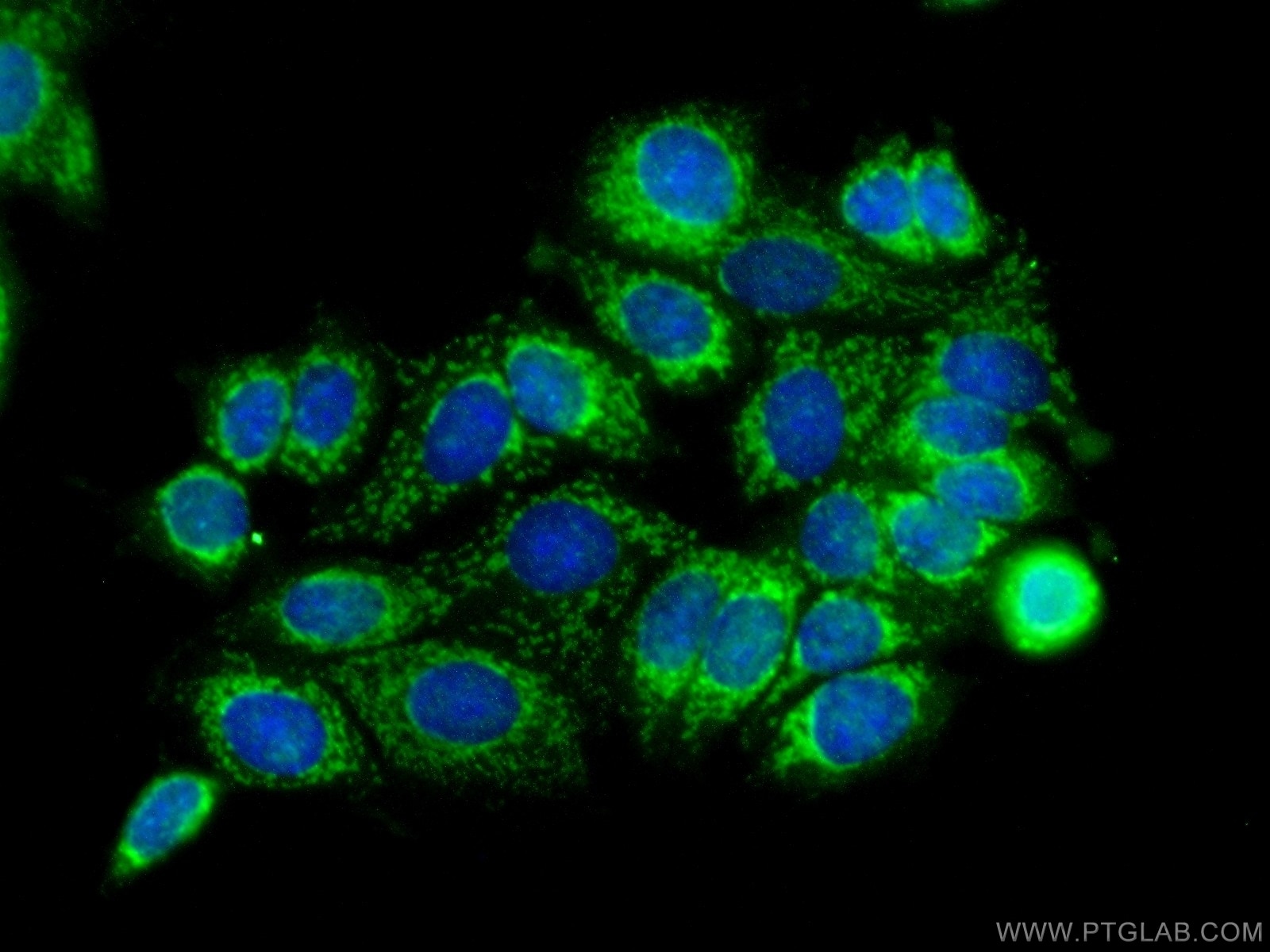 Immunofluorescence (IF) / fluorescent staining of MCF-7 cells using SMTNL2 Polyclonal antibody (14782-1-AP)