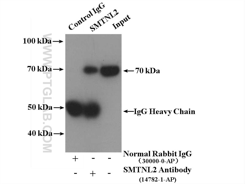 Immunoprecipitation (IP) experiment of COLO 320 cells using SMTNL2 Polyclonal antibody (14782-1-AP)