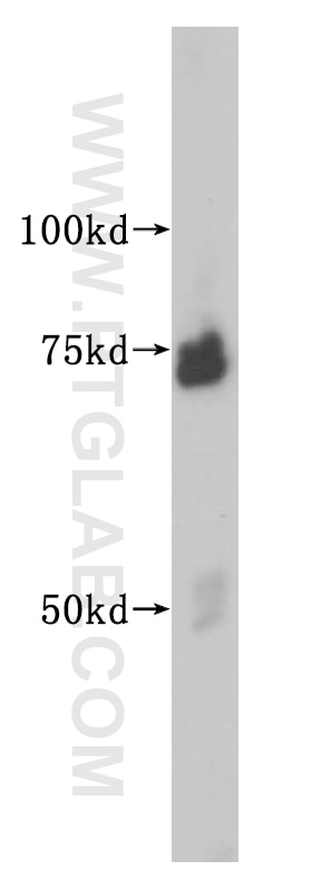 Western Blot (WB) analysis of SGC-7901 cells using SMTNL2 Polyclonal antibody (14782-1-AP)