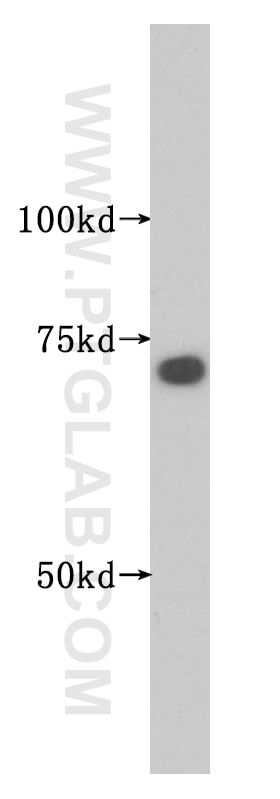 Western Blot (WB) analysis of COLO 320 cells using SMTNL2 Polyclonal antibody (14782-1-AP)