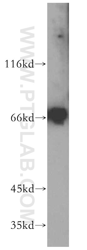 Western Blot (WB) analysis of MCF-7 cells using SMTNL2 Polyclonal antibody (14782-1-AP)