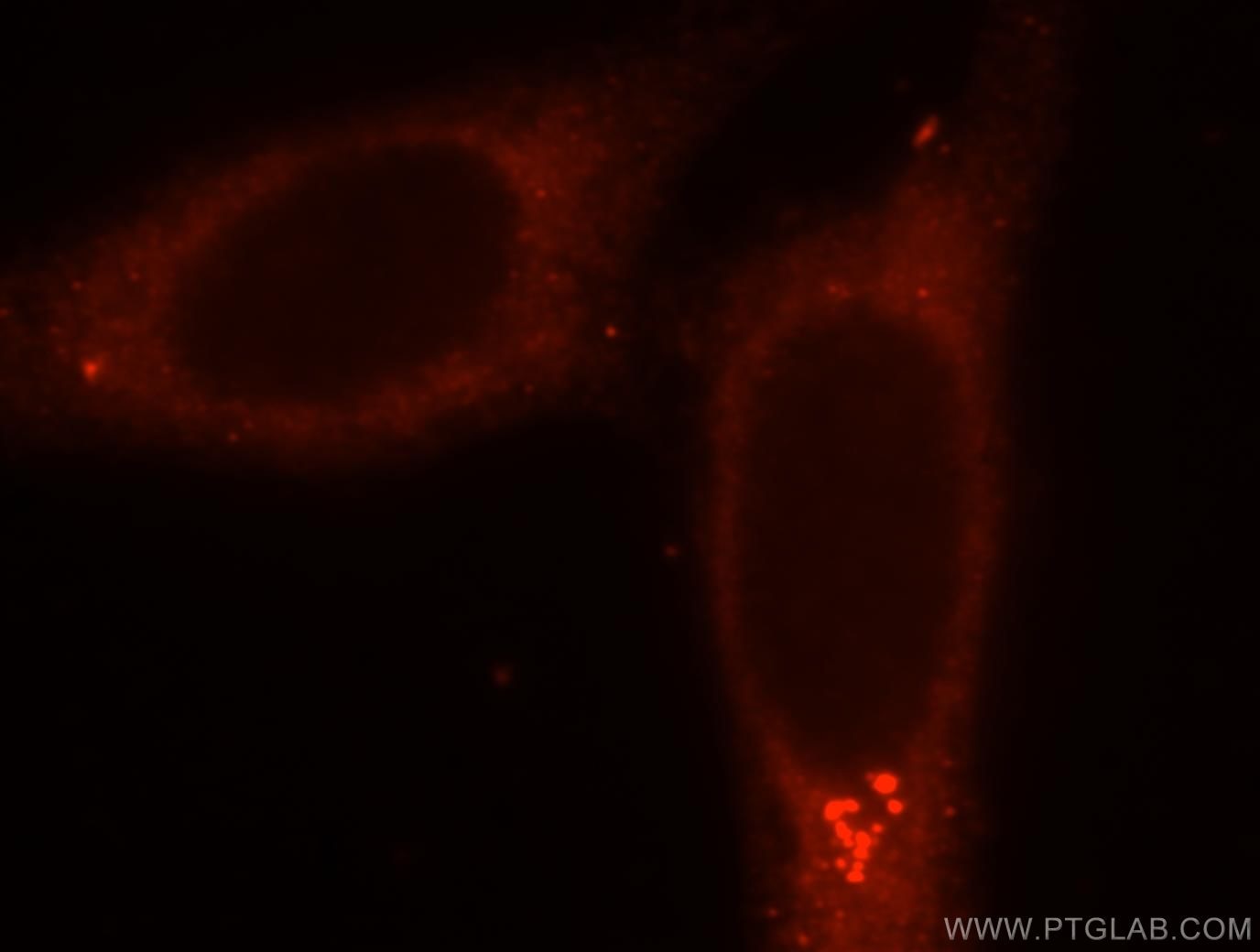 Immunofluorescence (IF) / fluorescent staining of HepG2 cells using SMU1 Polyclonal antibody (15511-1-AP)